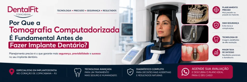 Por Que a Tomografia Computadorizada É Fundamental Antes de Fazer Implante Dentário?