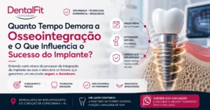 Quanto Tempo Demora a Osseointegração e O Que Influencia o Sucesso do Implante?