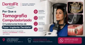 Por Que a Tomografia Computadorizada É Fundamental Antes de Fazer Implante Dentário?